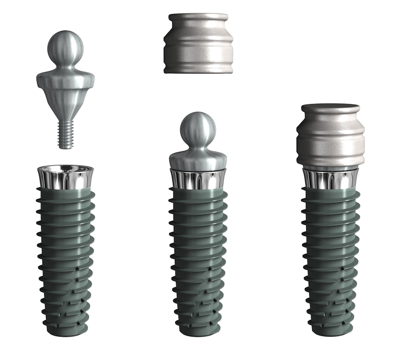 Kugelanker für Implantate