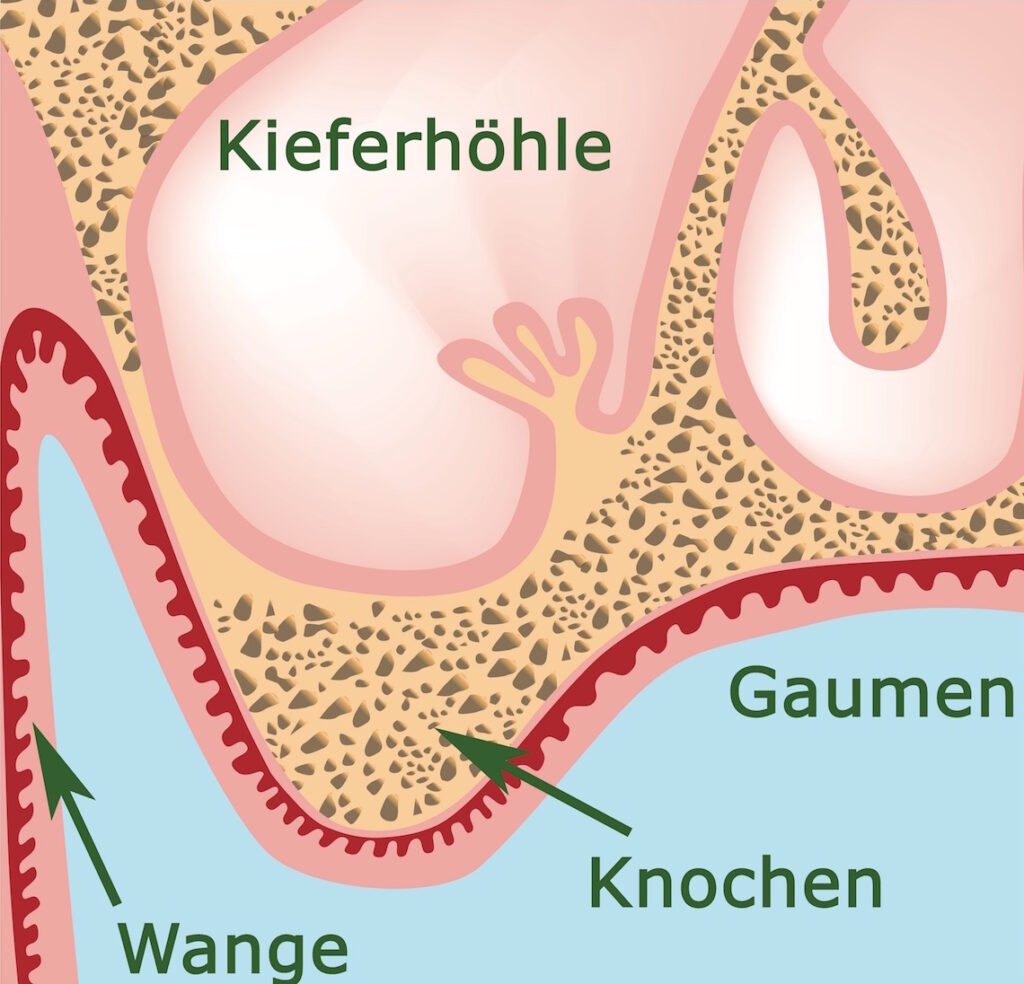 Kieferhöhle Sinus maxillaris